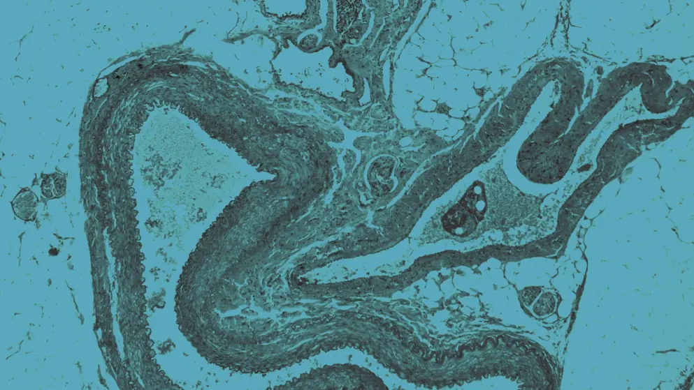 Human nervous system under the microscope, blue overlay