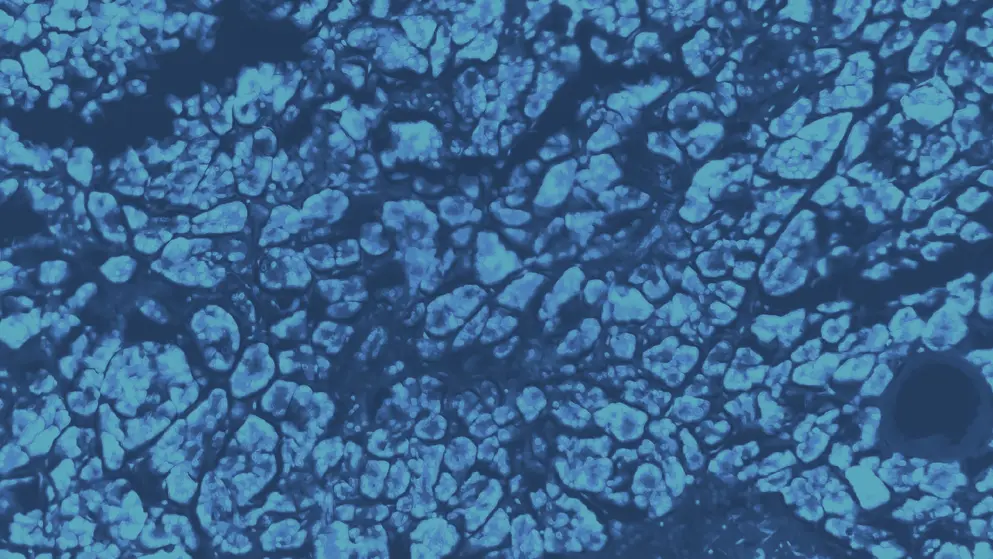 Histology of human pancreatic tissue, cellular image, blue overlay