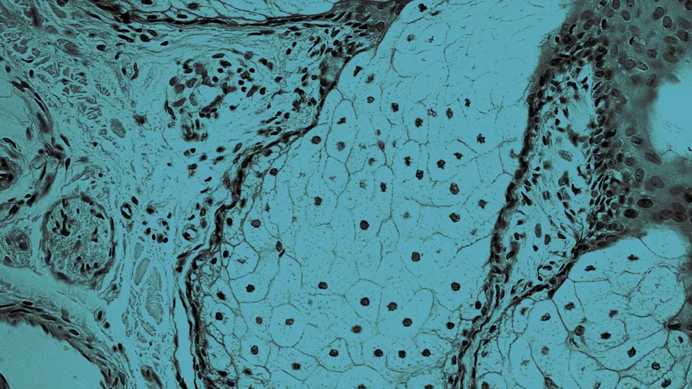 Cellular image of Human skin, Sebaceous gland, blue overlay