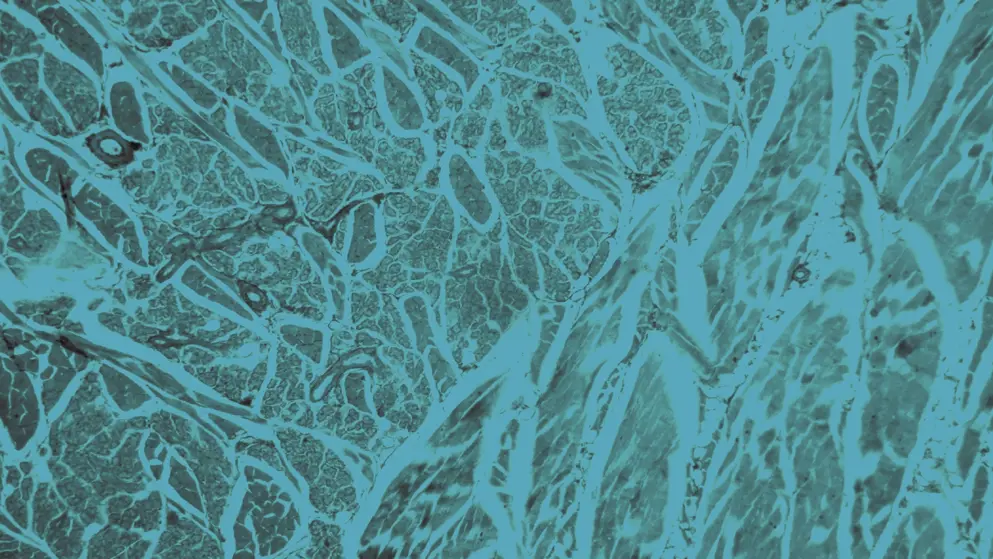 Lung Under microscope, cell image, blue overlay