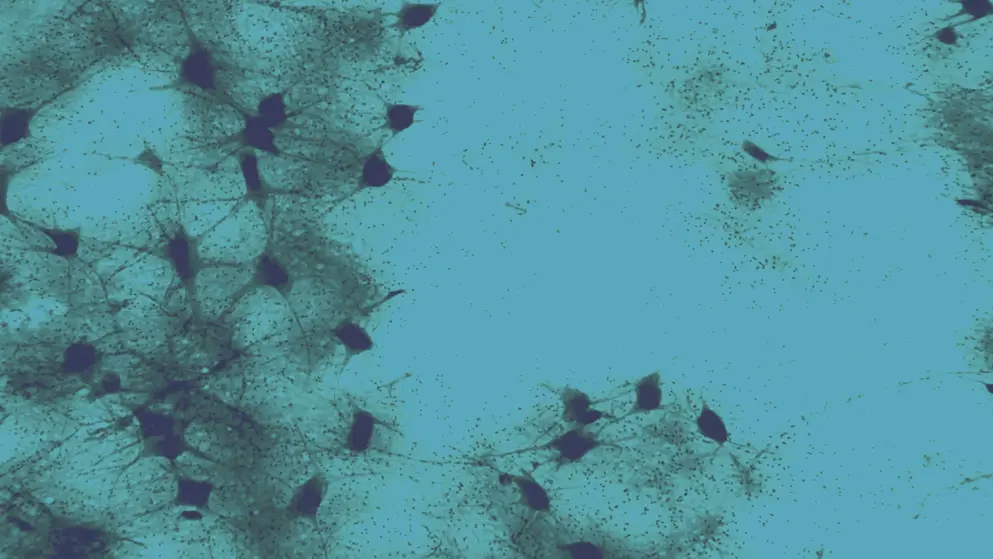 Motor neuron cells, blue overlay