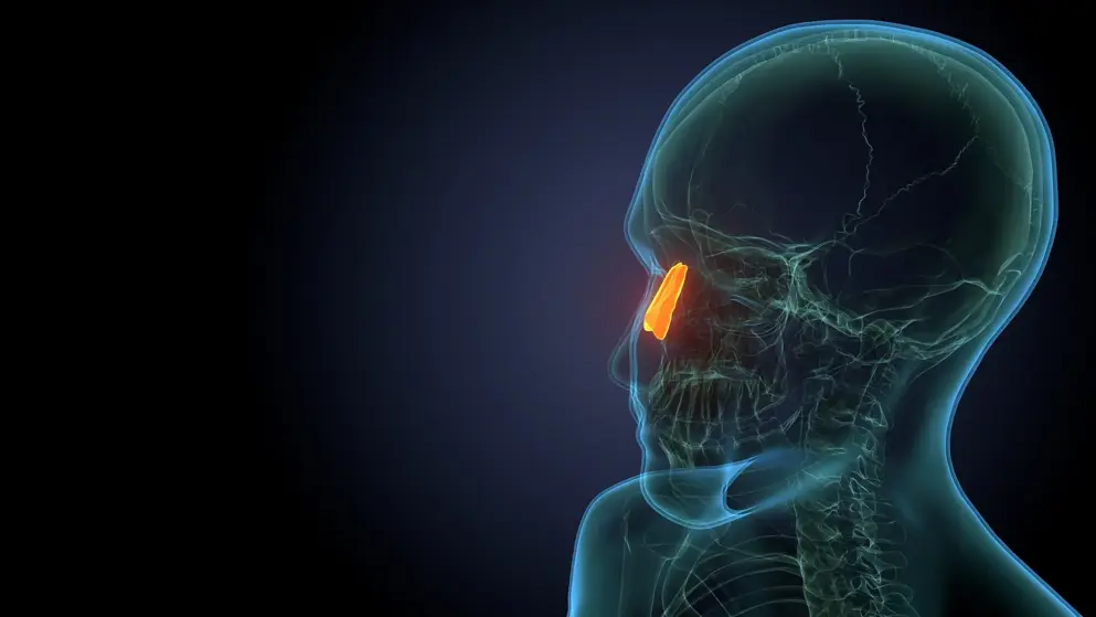 X-ray image of nasal polyps within a human head