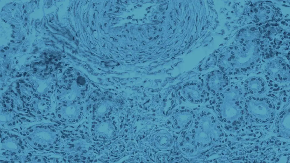 Olfactory epithelium, cellular image, blue overlay