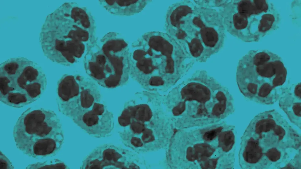 Polymorphonuclear leukocytes, cellular image, blue overlay