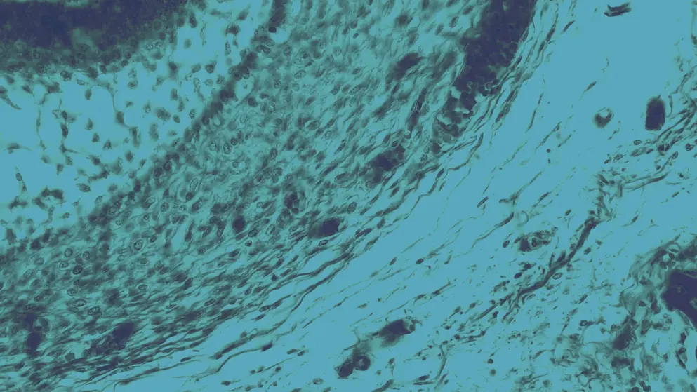 retina, cell image, blue overlay