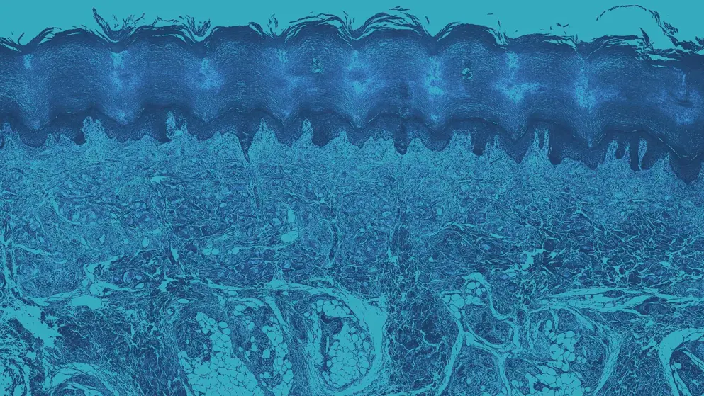 cellular image of Sole of the foot, blue overlay