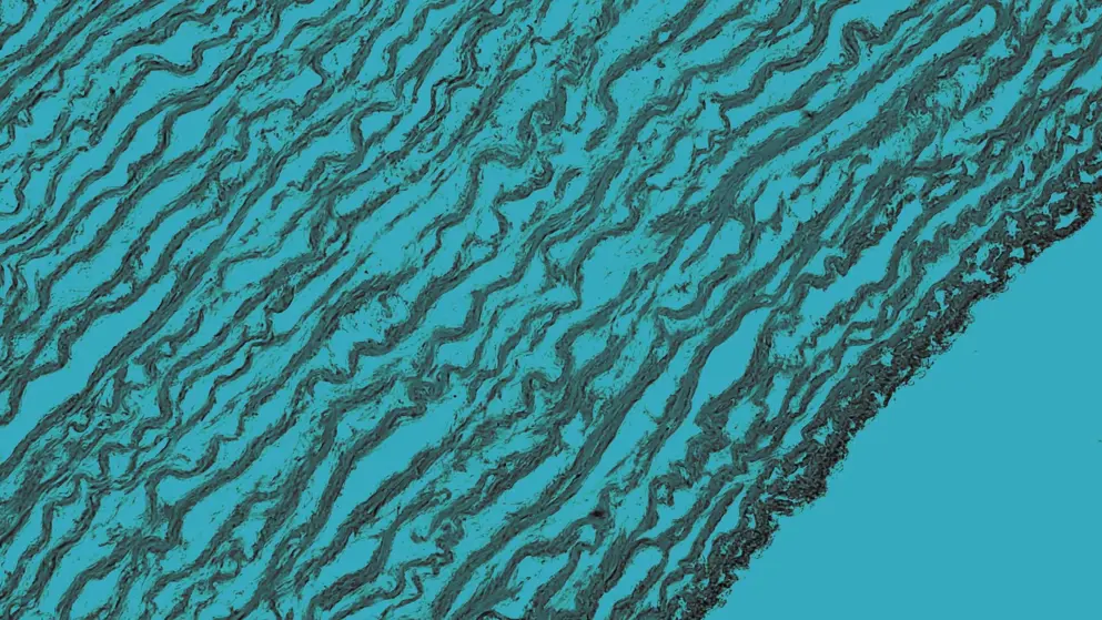 Cellular image, Tissue of arteries and veins, Blue overlay