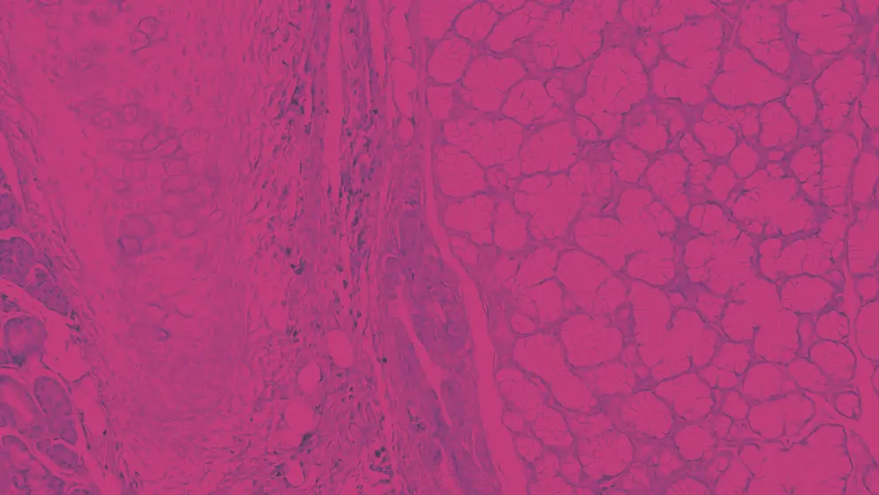 human tissue rendered in pink