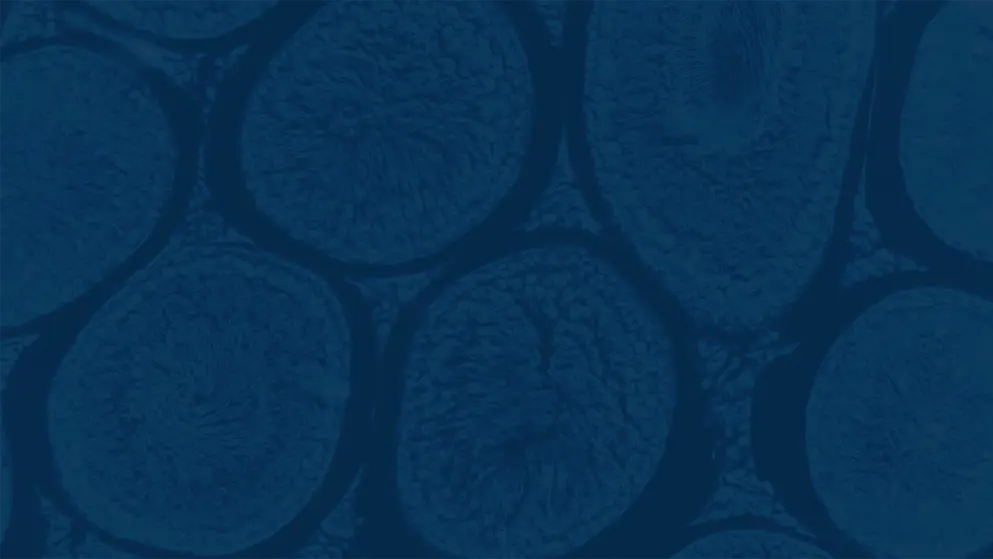 Micrograph of ovary tissue rendered in blues