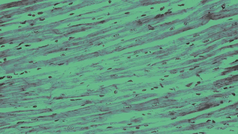 Cellular image, Human cardiac muscle, green overlay