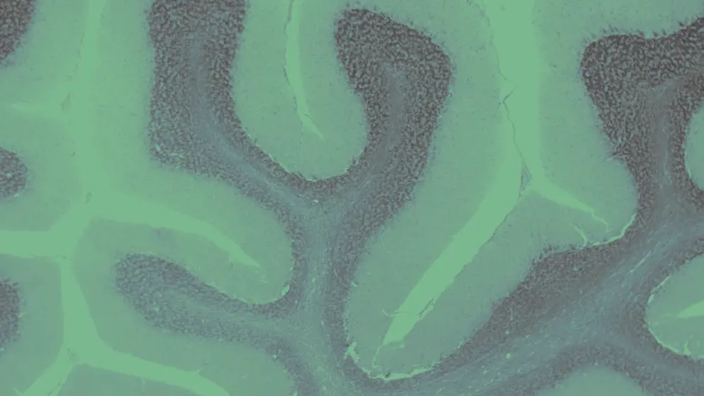 Human cerebellum under the microscope, green overlay
