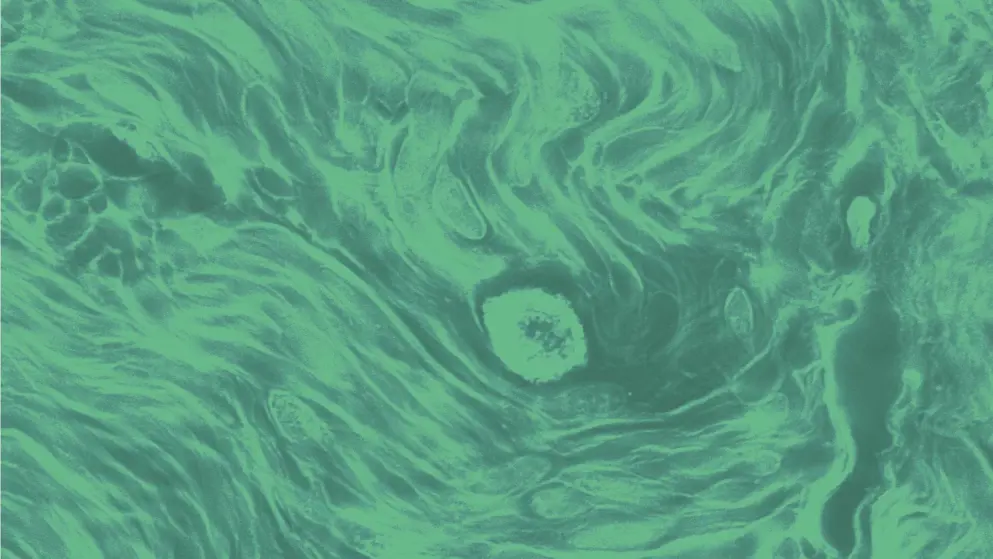 Mast cell, cellular image, green