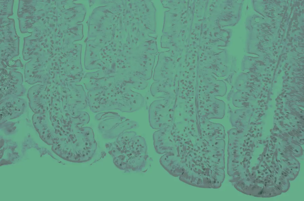 Mucosal lining of normal colon, cellular image, green overlay