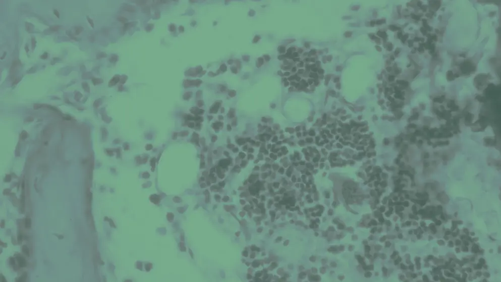 Red bone marrow, cellular image, green overlay