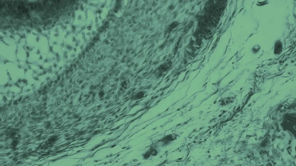 Retina, human eye, cell image, green overlay