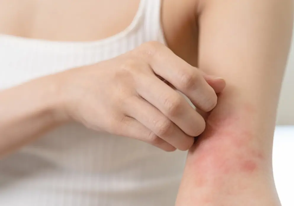 Woman with itchy arm