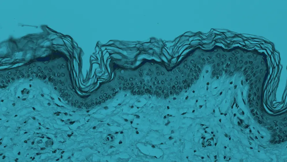 microsopic image of thin sckin on a blue background