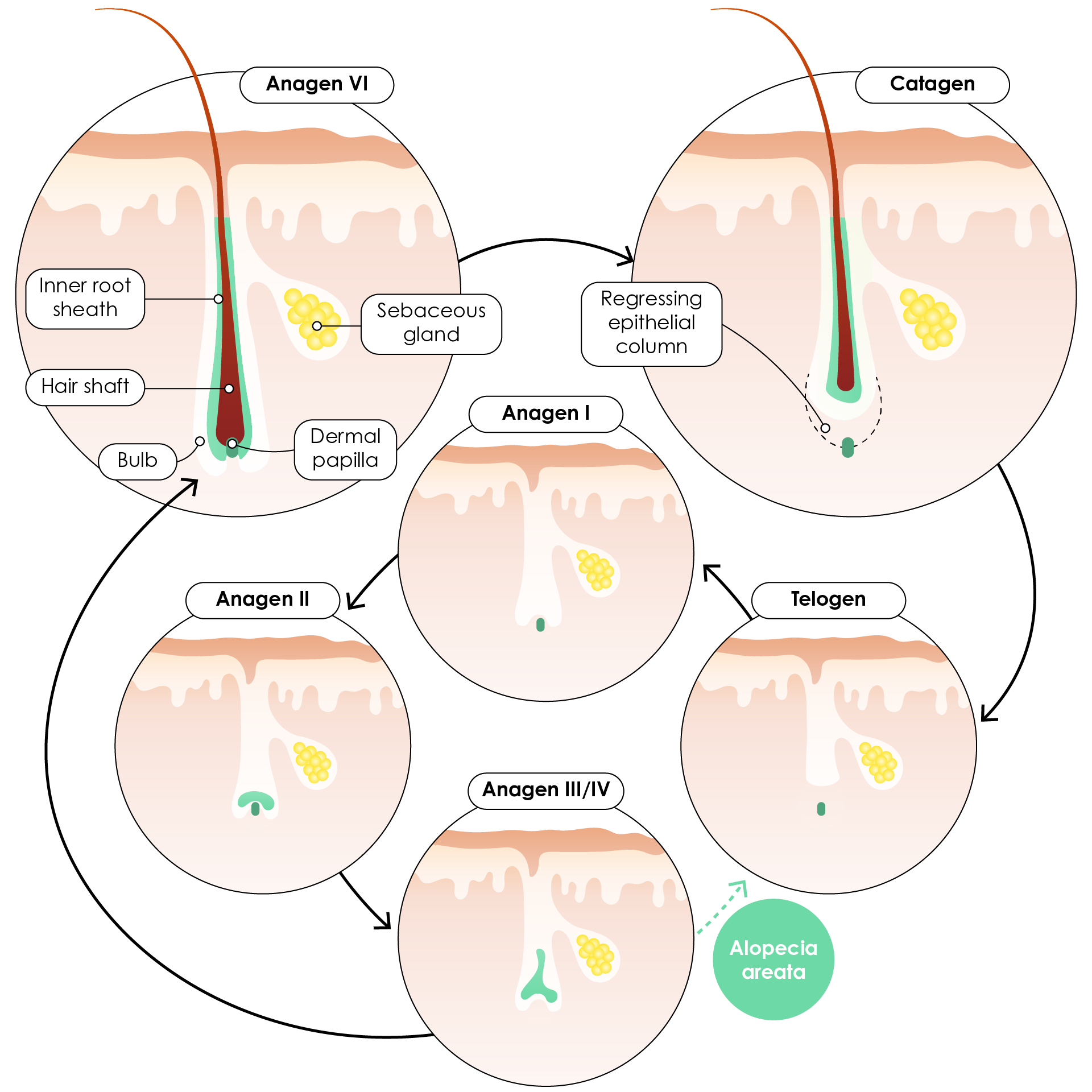 The hair cycle in alopecia areata