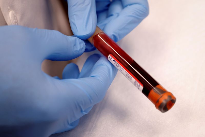 Health Rounds: Blood test finds early ovarian cancer-