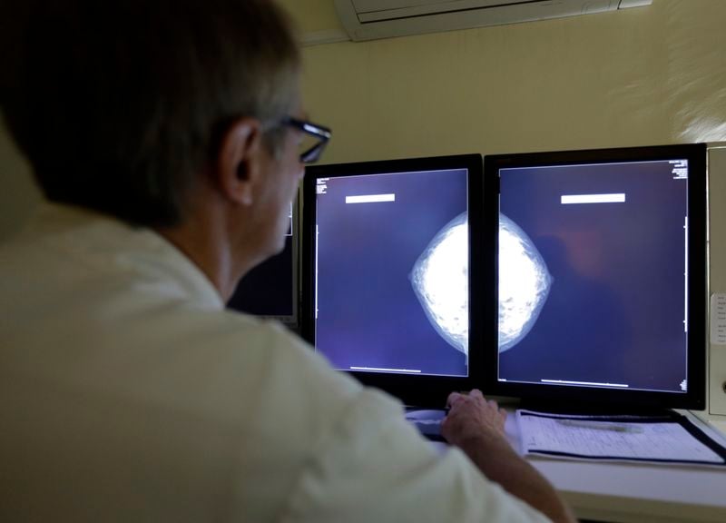 Health Rounds: Genomic testing improves treatment, survival for Black breast cancer patients-